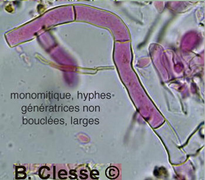 Botryobasidium vagum