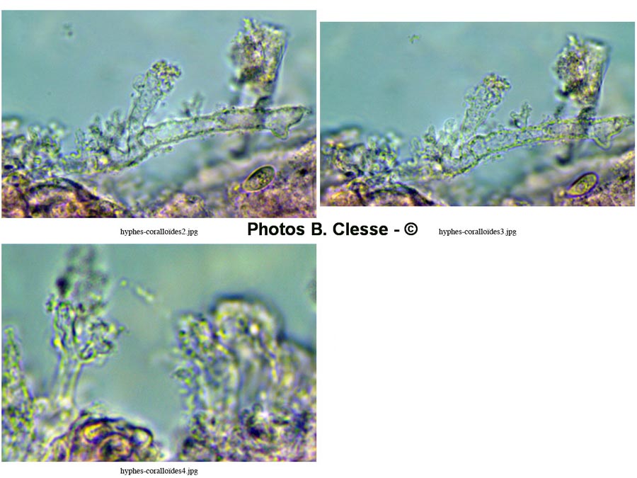 Calyptella capula