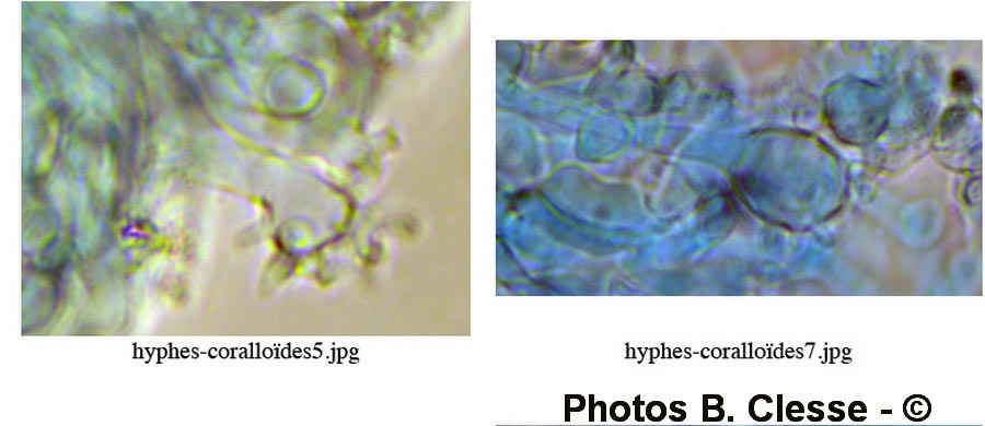 Calyptella capula