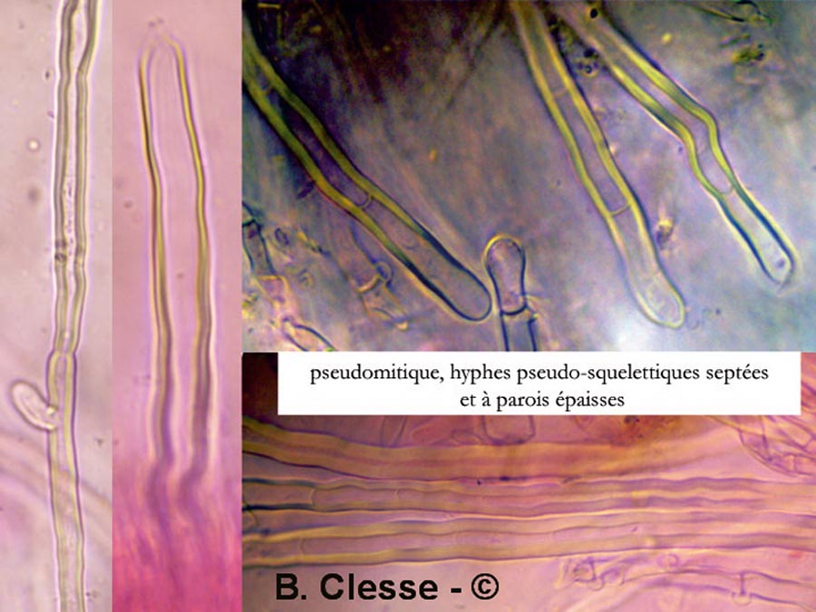 Fibrodontia gossypina