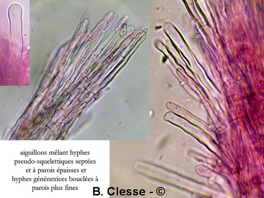 Fibrodontia gossypina