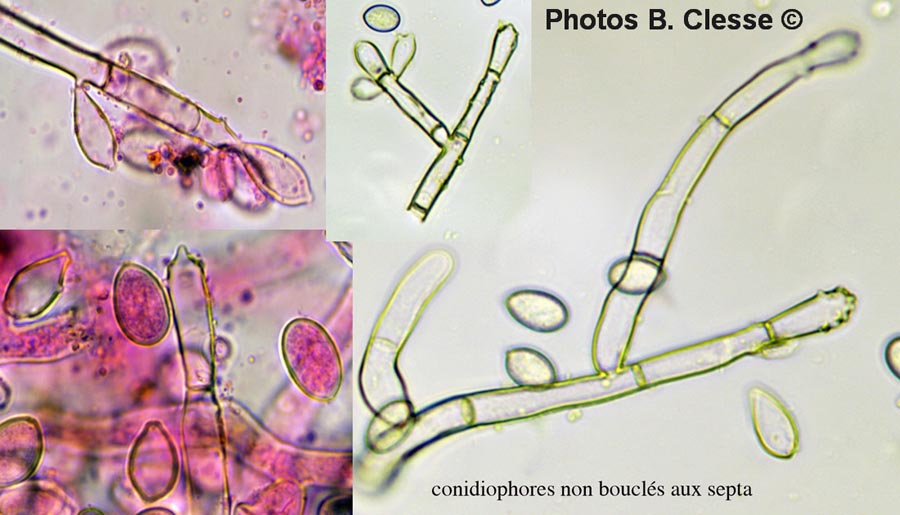 Haplotrichum capitatum (Botryobasidium candicans)