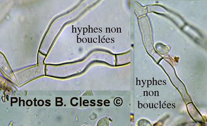 Helicobasidium brebissonii