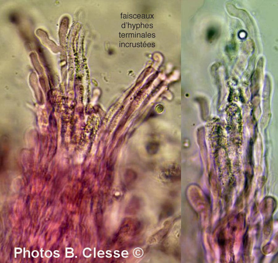 Hyphodermella corrugata