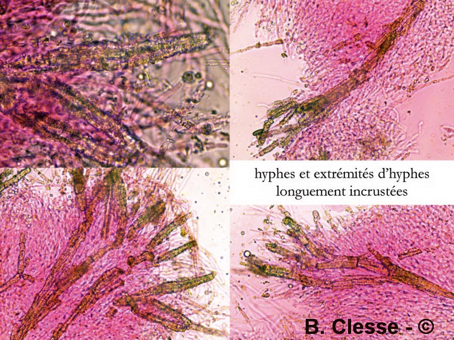 Hyphodermella corrugata