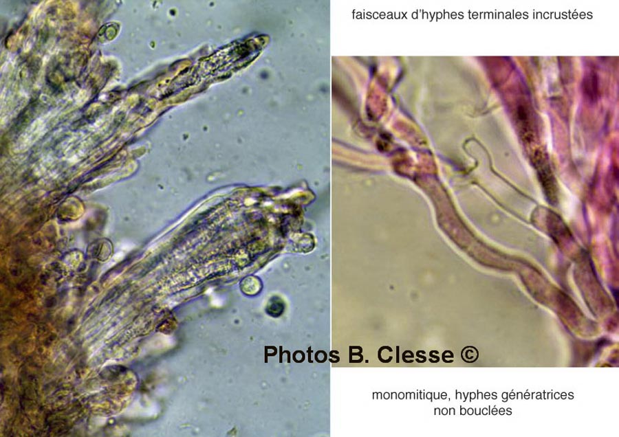 Hyphodermella corrugata