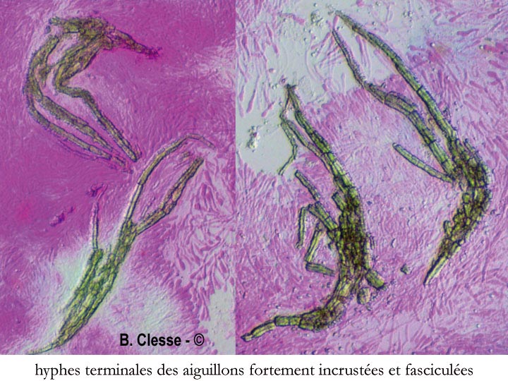 Hyphodermella corrugata