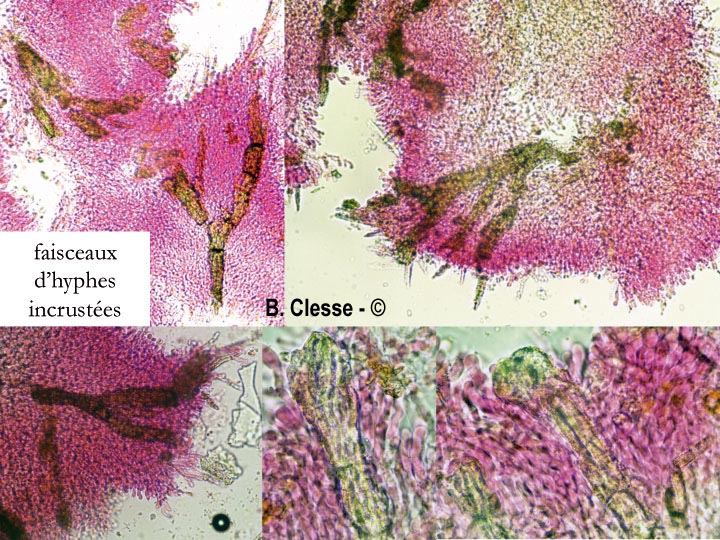 Hyphodermella densa