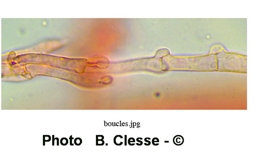 Inocybe perlata