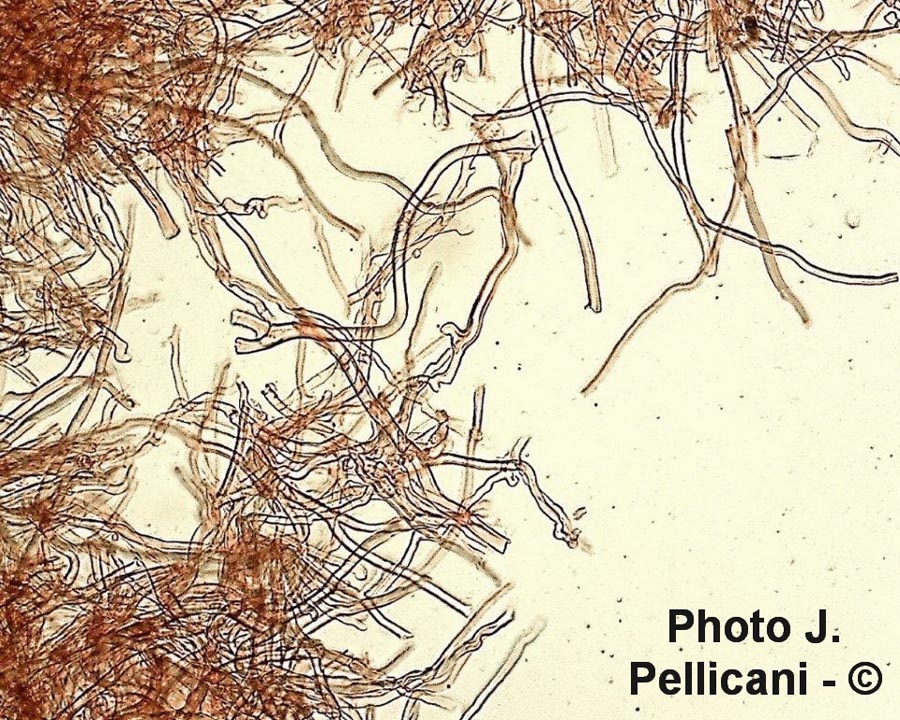 Ischnoderma resinosum