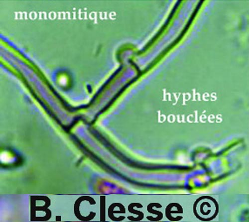 Lyomyces sambuci