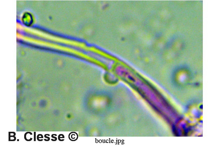 Lyomyces sambuci