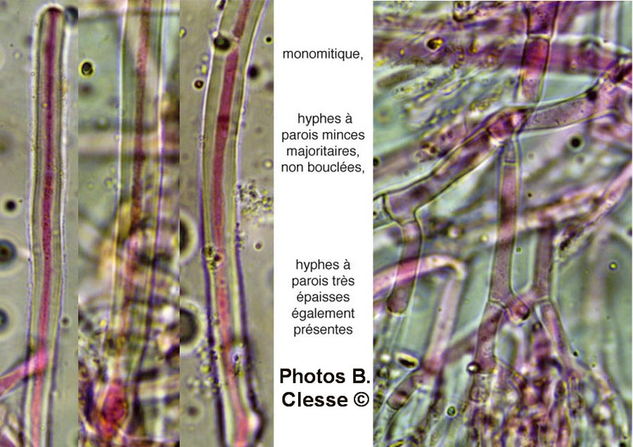 Odonticium septocystidia