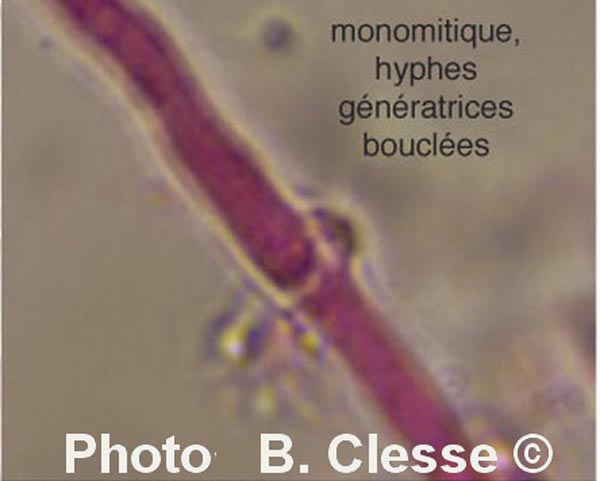 Peniophorella praetermissa (Hyphoderma praetermissum)