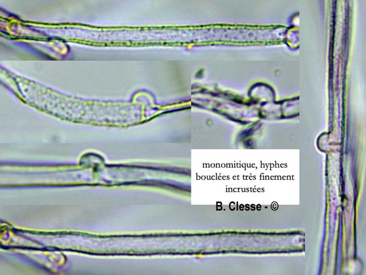 Amphinema byssoides
