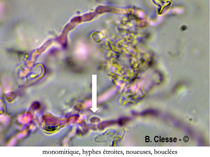 Radulomyces molaris (Cerocorticium molare)