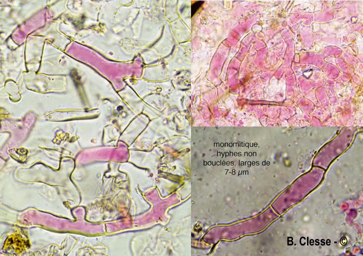Rhizoctonia fusispora (Thanatephorus fusisporus)