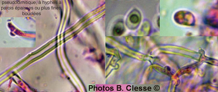 Schizopora radula