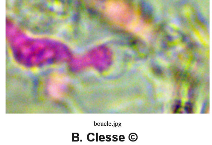 Sistotrema diademiferum