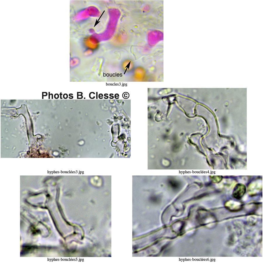 Sistotrema diademiferum