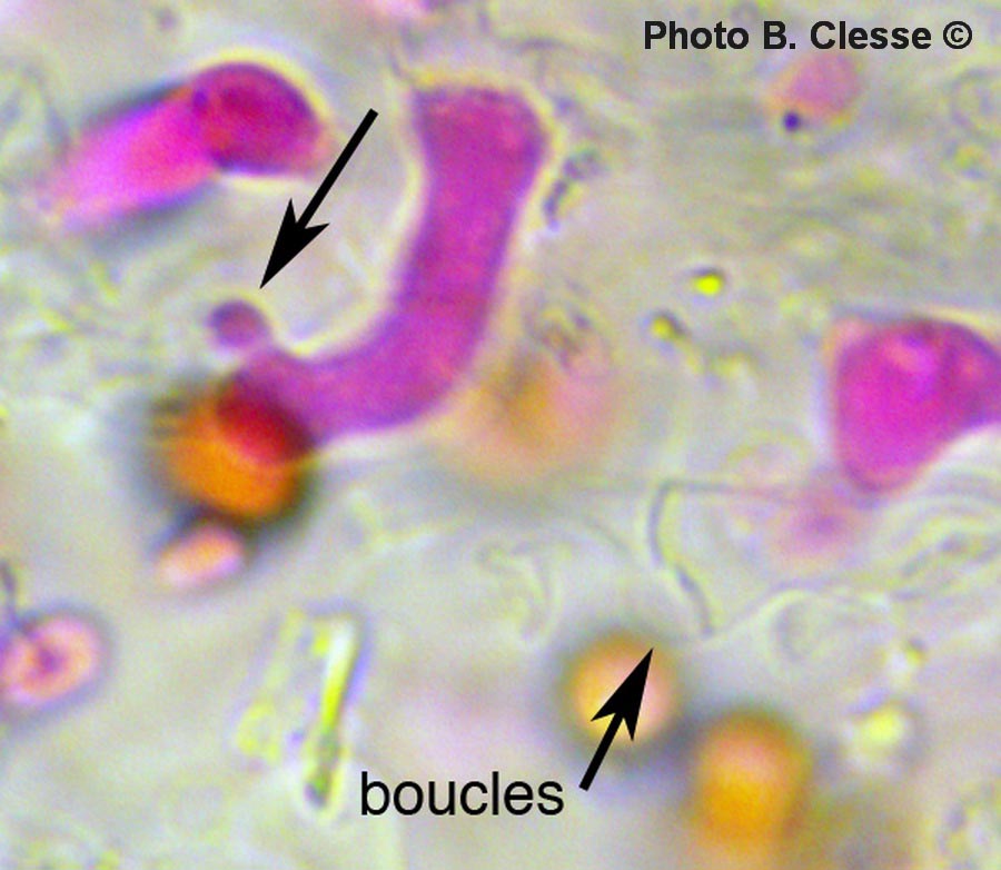 Sistotrema diademiferum