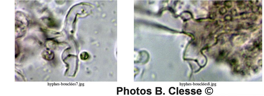 Sistotrema diademiferum