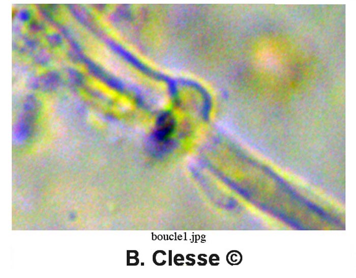 Skeletocutis lilacina