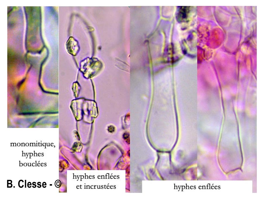 Trechispora hymenocystis