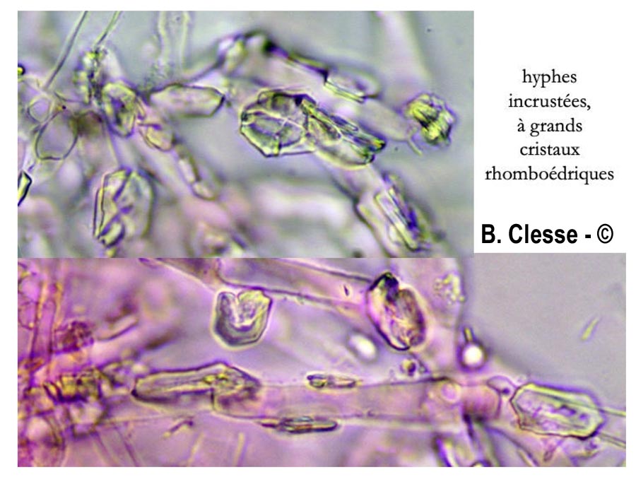 Trechispora hymenocystis