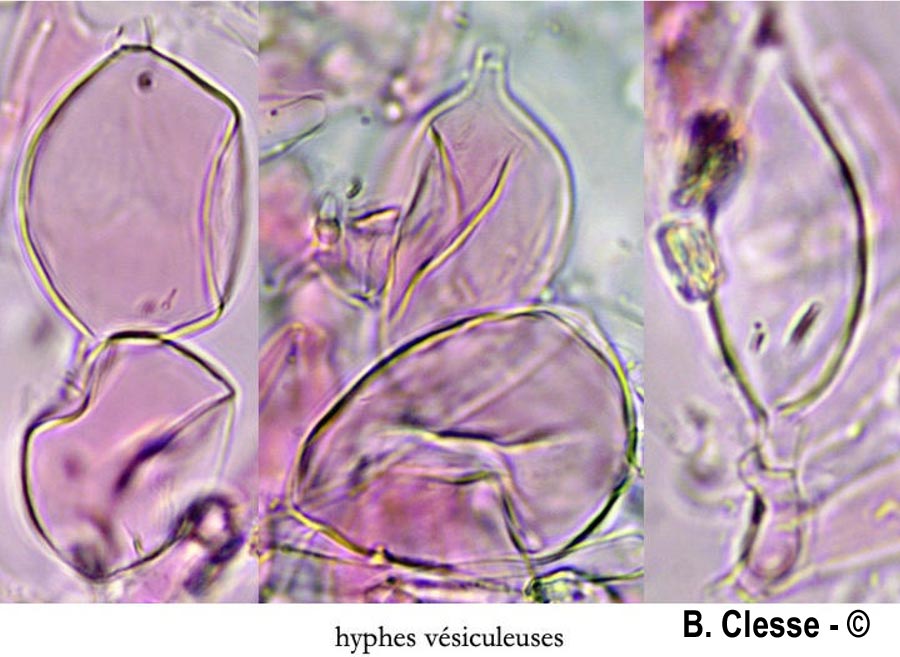 Trechispora hymenocystis