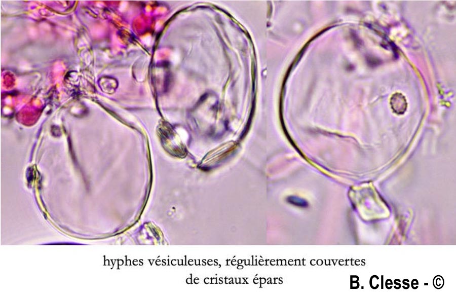 Trechispora hymenocystis