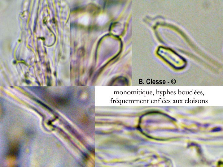 Trechispora microspora
