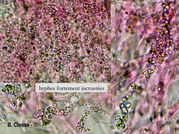 Trechispora mollusca