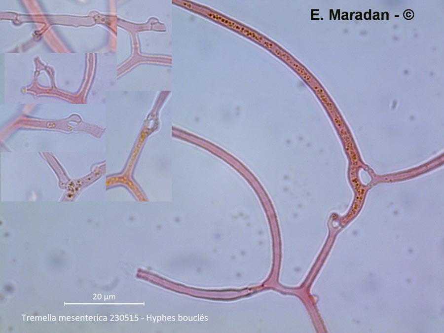 Tremella mesenterica