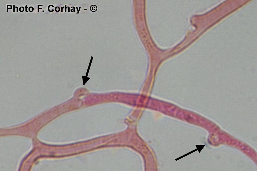 Tremella mesenterica