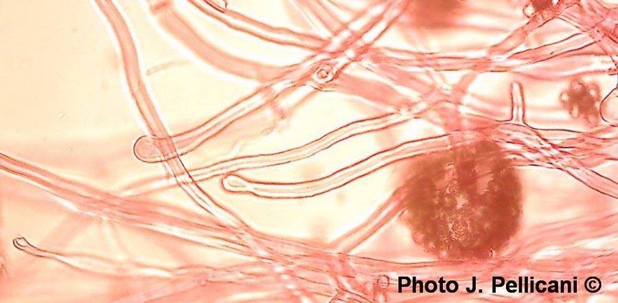 Tulostoma squamosum