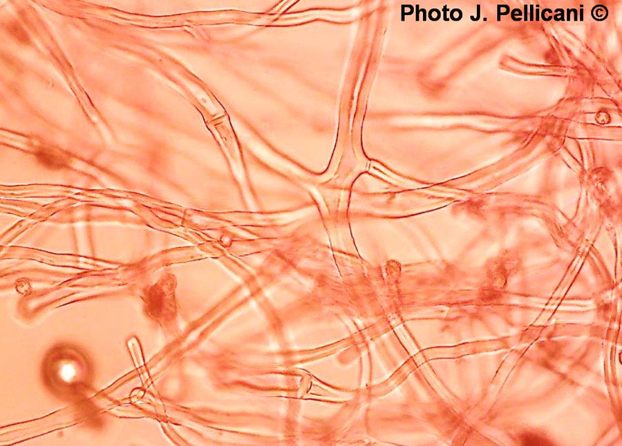 Tulostoma squamosum