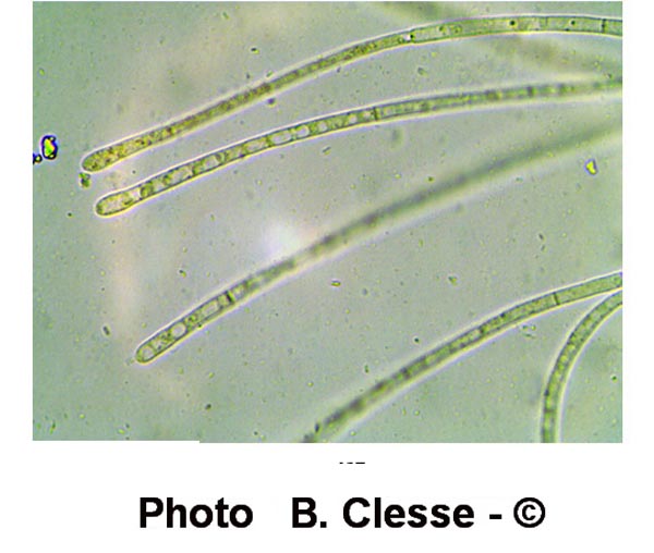 Anthracobia melaloma