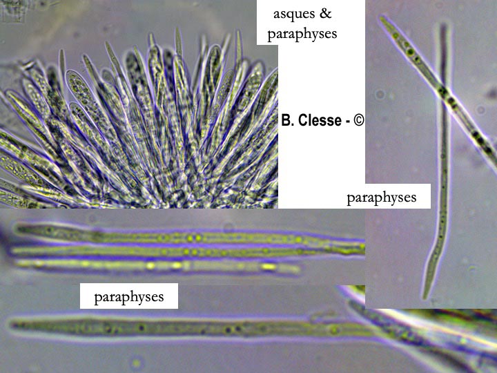 Incrucipulum ciliare