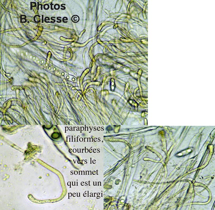 Octospora musci-muralis