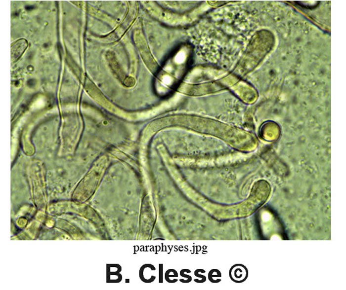 Octospora musci-muralis