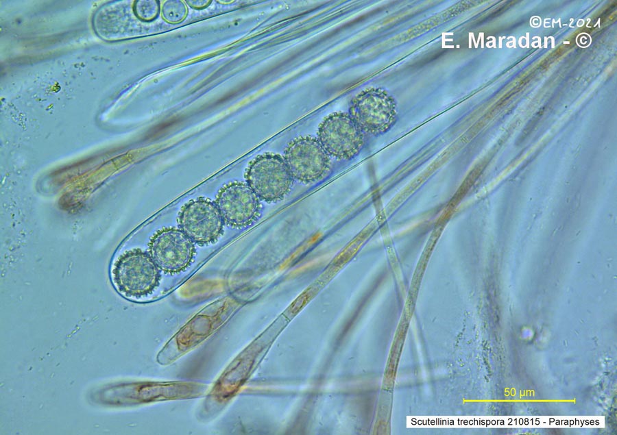 Scutellinia trechispora