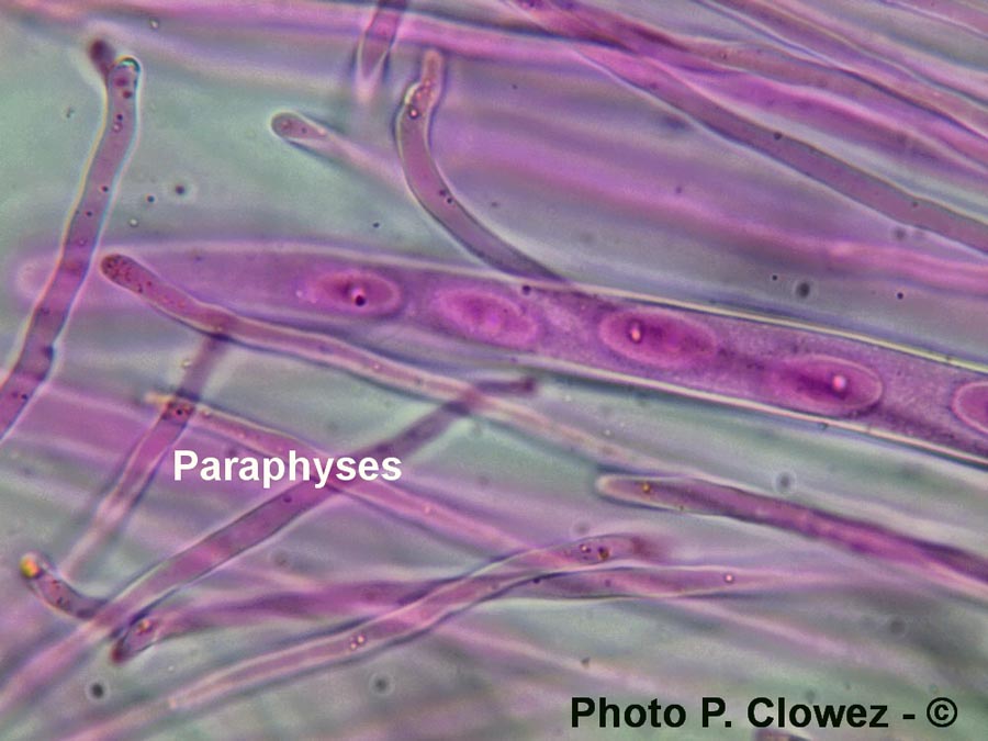 Sowerbyella polaripustulata