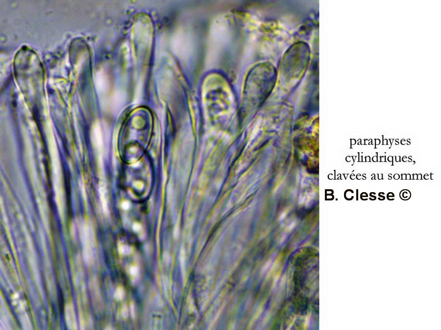 Trichophaea abundans