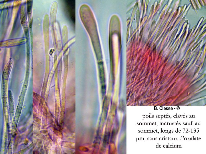 Dasyscyphella montana