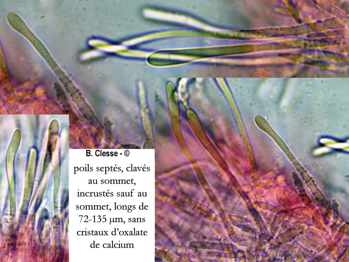 Dasyscyphella montana