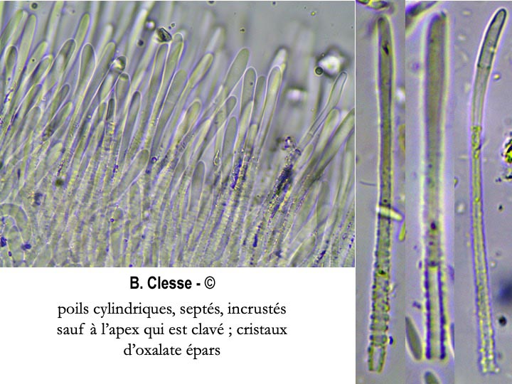 Dasyscyphella nivea