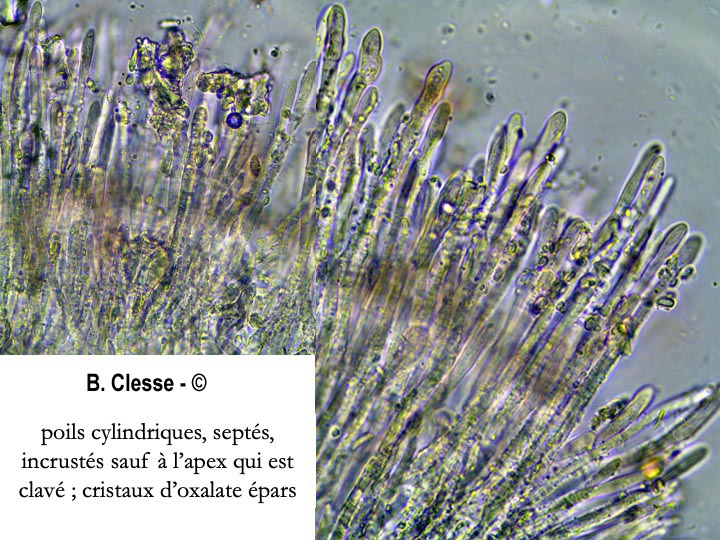 Dasyscyphella nivea