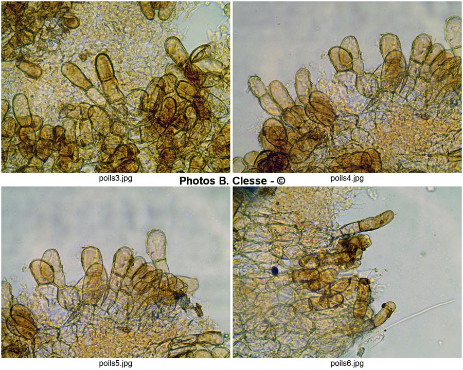 Melastiza cornubiensis