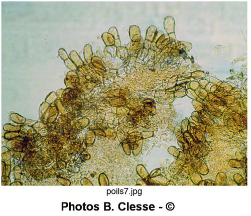 Melastiza cornubiensis